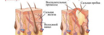 Секрет популярності ізраїльської косметики
